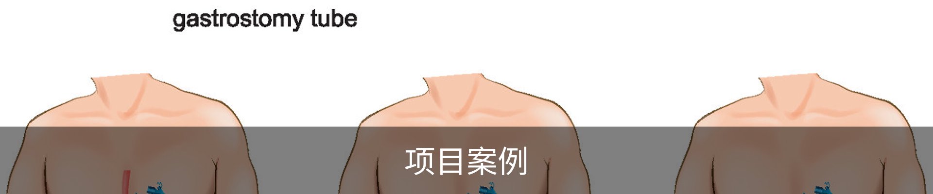 项目案例